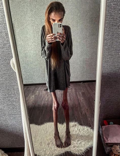 anorexic porn|Anorexic Porn Videos